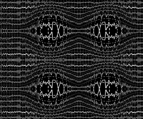 Brain waves on encephalogramme EEG